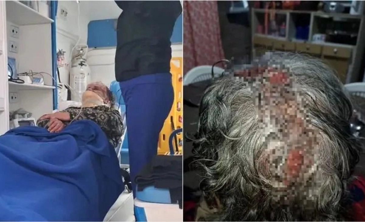 Una mujer mayor está sin agua hace meses y sufrió un accidente al querer sacar de una cisterna